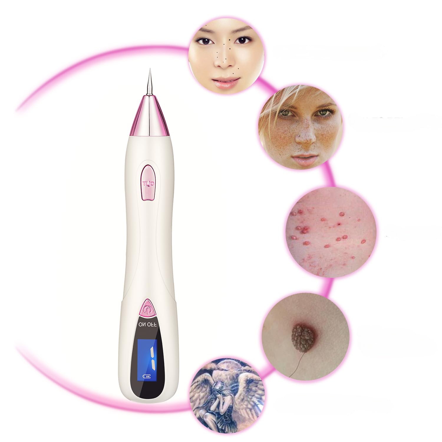 Skin Tag Remover Pen - 9 Levels Portable Mole Removal Kit, Home Use Tag Buddy Beauty Tool Set, FDA Cleared Device