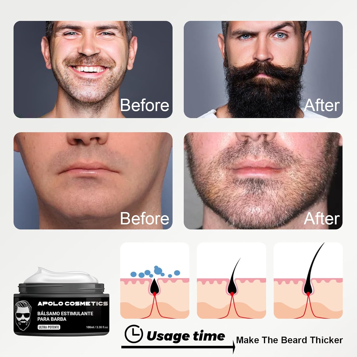 Para Barba, Apolo Ultra Potente Estimulante de Barba, Bálsamo para Crecimiento de Barba Crema, Balsamo Negro para Hombr, Humectan y Fortalecen tu Barba, Sin Irritación 100ml/3.38floz (1 PC, 1)
