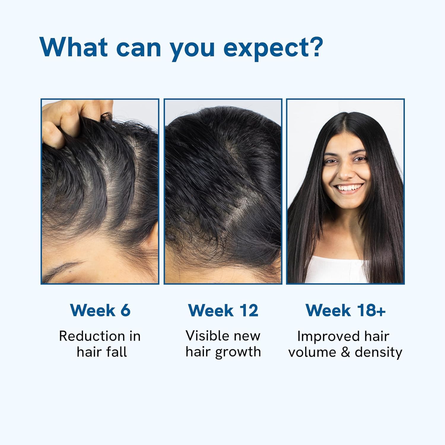 Be Bodywise Rosemary Hair Growth Serum (Roll On) | 3% Redensyl & 2% Anagain | Hair fall control serum for Women & Men | Promotes Hair Growth & Stimulates Hair Follicles | For All Hair Types | 25ml