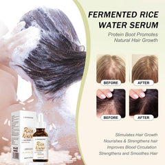 Rice Water Hair Growth Oil & Strengthening Serum – Nourishing Treatment for Thinning, Dry, or Damaged Hair – Promotes Stronger, Thicker, Longer Hair for Men & Women