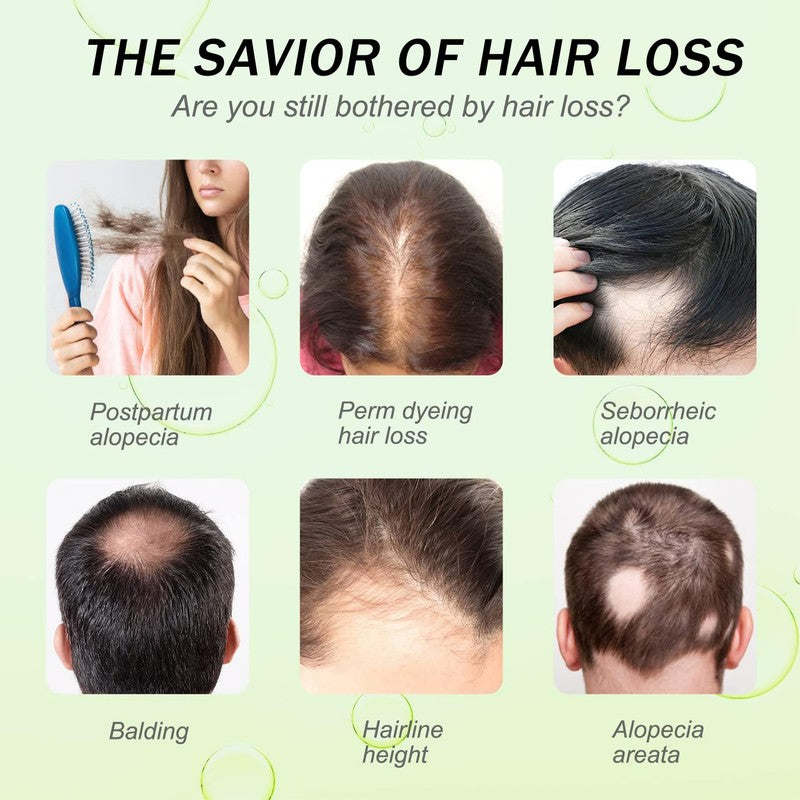 Rice Water Hair Growth Oil & Strengthening Serum – Nourishing Treatment for Thinning, Dry, or Damaged Hair – Promotes Stronger, Thicker, Longer Hair for Men & Women