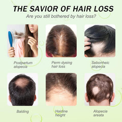 Rice Water Hair Growth Oil & Strengthening Serum – Nourishing Treatment for Thinning, Dry, or Damaged Hair – Promotes Stronger, Thicker, Longer Hair for Men & Women