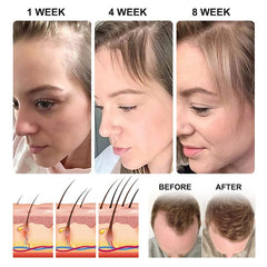 Rice Water Hair Growth Oil & Strengthening Serum – Nourishing Treatment for Thinning, Dry, or Damaged Hair – Promotes Stronger, Thicker, Longer Hair for Men & Women