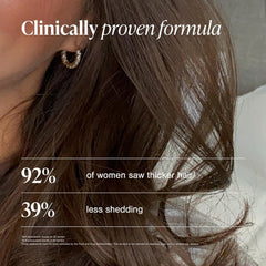 Viviscal Women’s Hair Growth Supplements – Thicker, Fuller Hair Support for Thinning & Hair Loss with Biotin & Marine Collagen – Drug-Free, 180 Tablets (90-Day Supply)