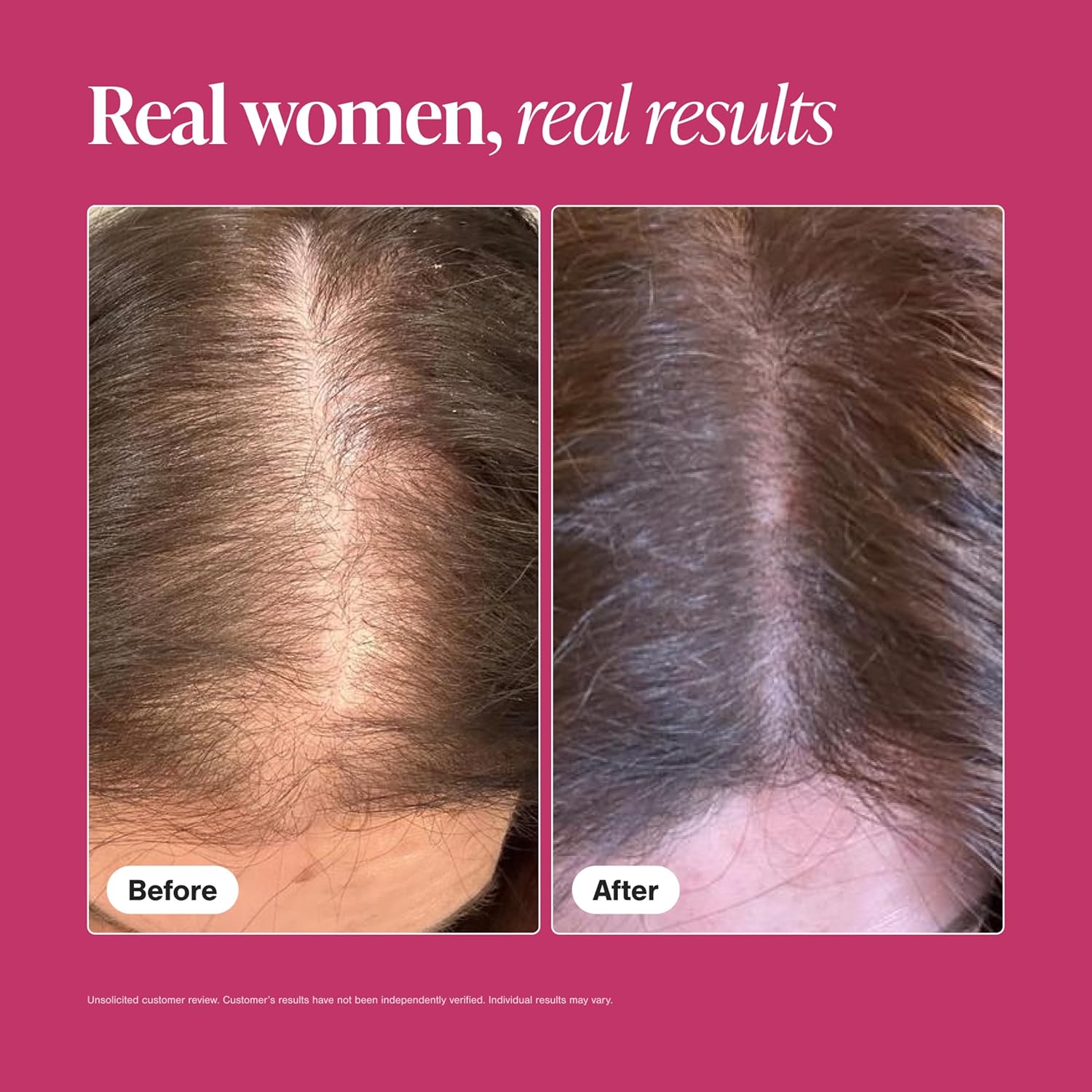 Viviscal Women’s Hair Growth Supplements – Thicker, Fuller Hair Support for Thinning & Hair Loss with Biotin & Marine Collagen – Drug-Free, 180 Tablets (90-Day Supply)