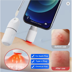 1/2 Pcs Electronic Mosquito Bite Relief Pen – Chemical-Free Anti-Itch Insect Bite Treatment for Camping & Travel